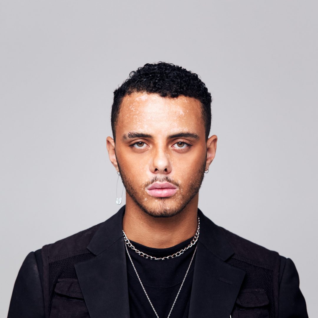 Studio Portrait Of Young Man With Skin Pigmentation Disorder Looking At Camera